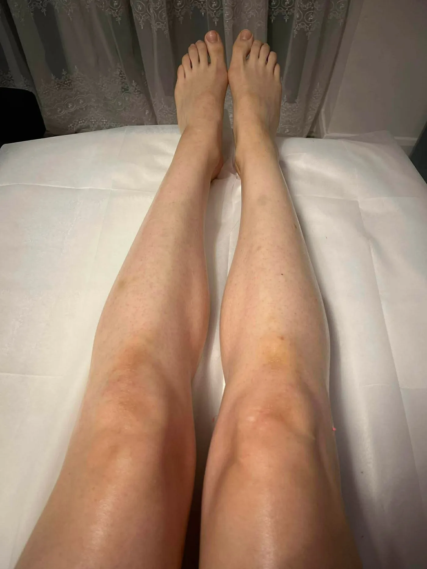 Legs before and after waxing — after